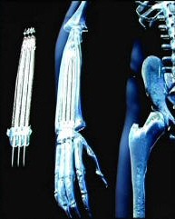 Wolverine_XRays.JPG