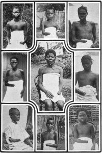 MutilatedChildrenFromCongo.jpg